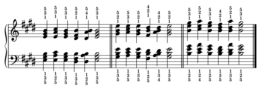 Cadence chord progressions in the key of E major starting from each inversion of the E major triad